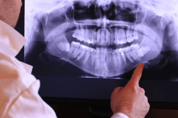 Best Emergency Denture Repair in Pu, HI