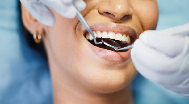 Best Emergency Dental Care for Sports Injuries in Pu, HI